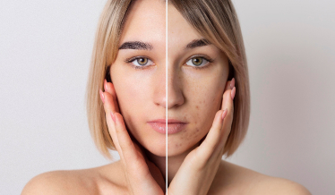 Сахарное лицо и преждевременное старение