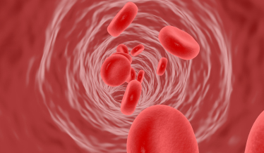 Атеросклероз