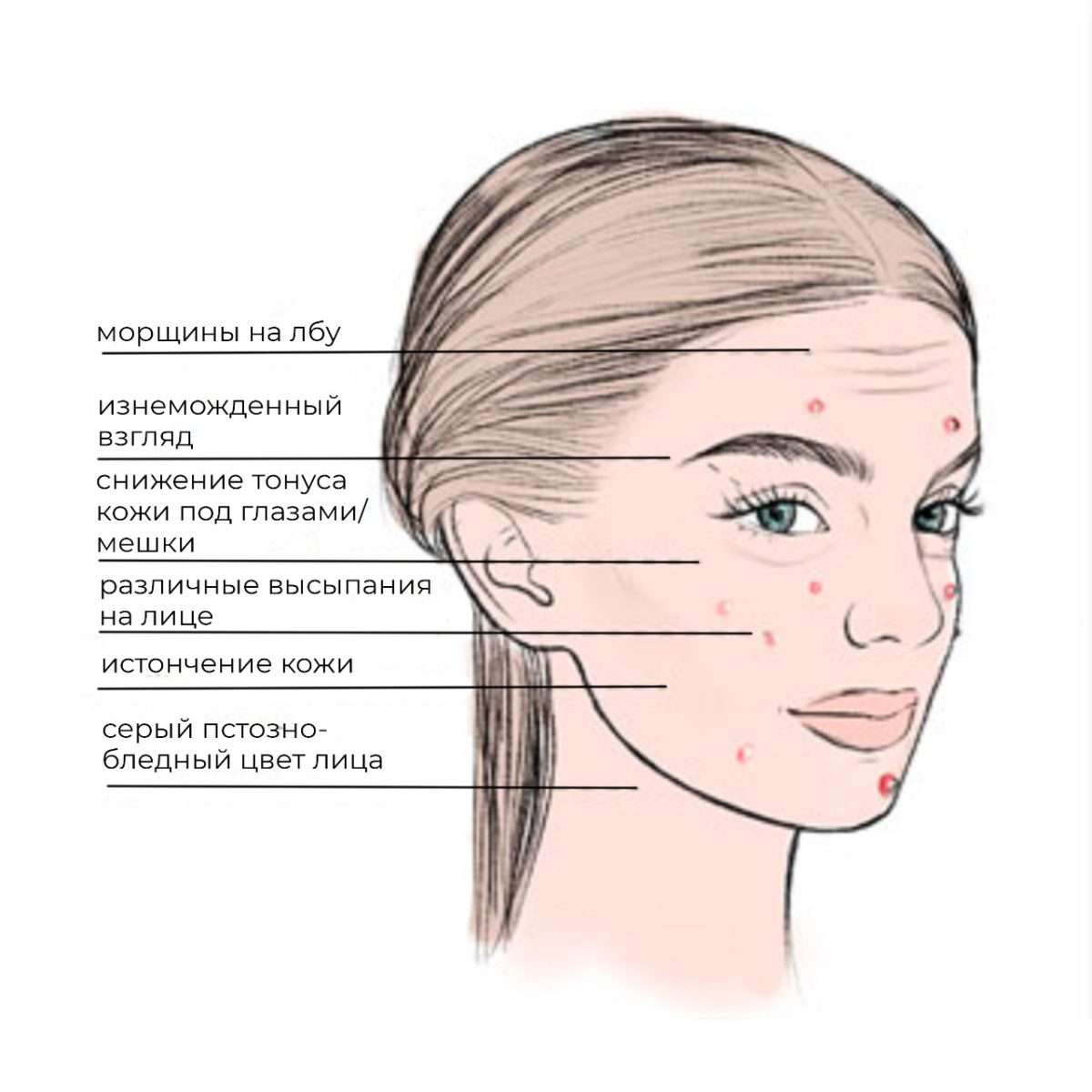 Признаки сахарного лица