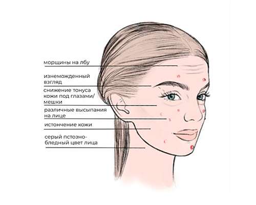 Сахарное лицо