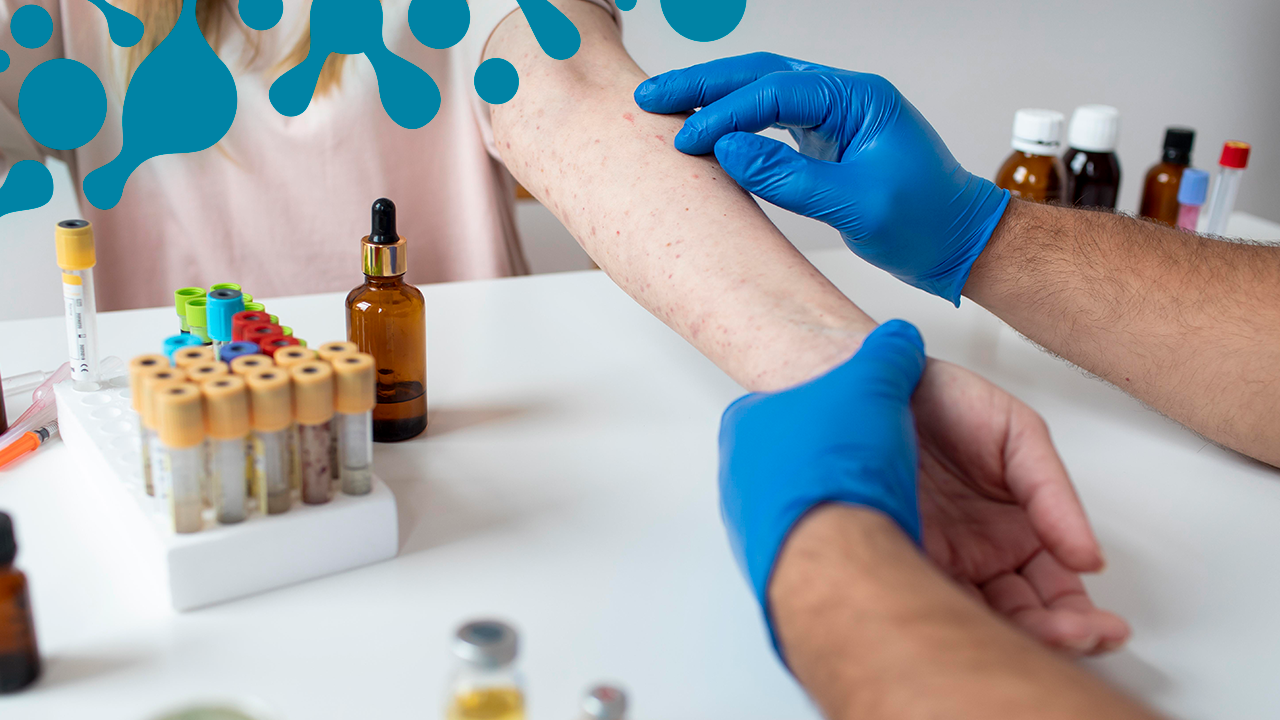 Тестирование на атопии Тестирование на атопии